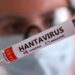 Duas pessoas retiradas de navio testam positivo para o hantavírus
